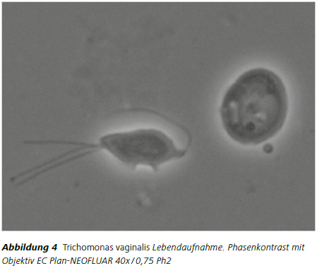 Abbildung 4 Trichomonas vaginalis Lebendaufnahme. Phasenkontrast mit Objektiv EC Plan-NEOFLUAR 40x / 0,75 Ph2